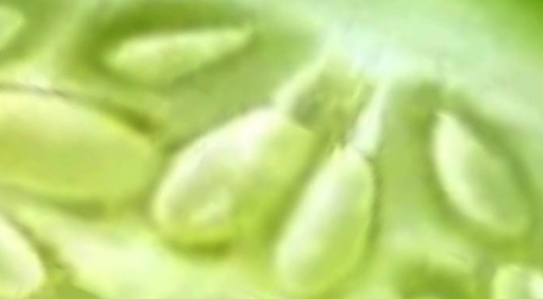 They Hid This From Seniors: It Unclogs Arteries INSTANTLY! | Barbara O’Neill